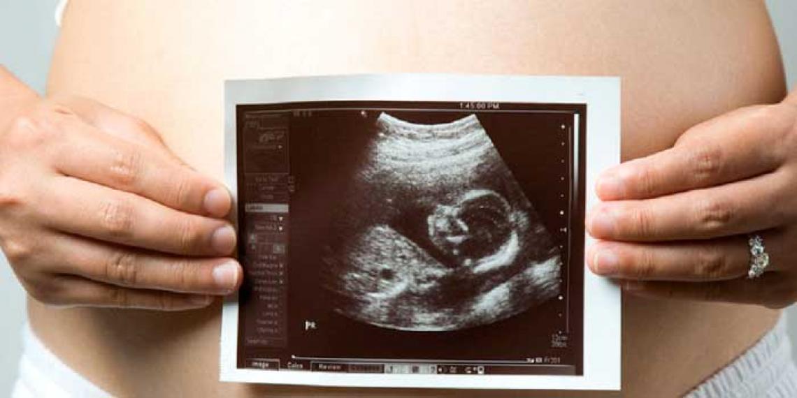 A mother shows a scan of her unborn baby